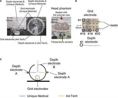 Evaluating the Safety of Simultaneous Intracranial Electroencephalography and Functional Magnetic Resonance Imaging Acquisition Using a 3 Tesla Magnetic Resonance Imaging Scanner